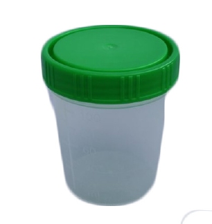 Urinebeker met groen schroefdeksel 100 ml