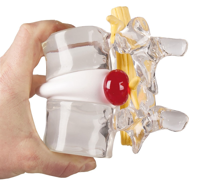 Hernia schijfsimulator